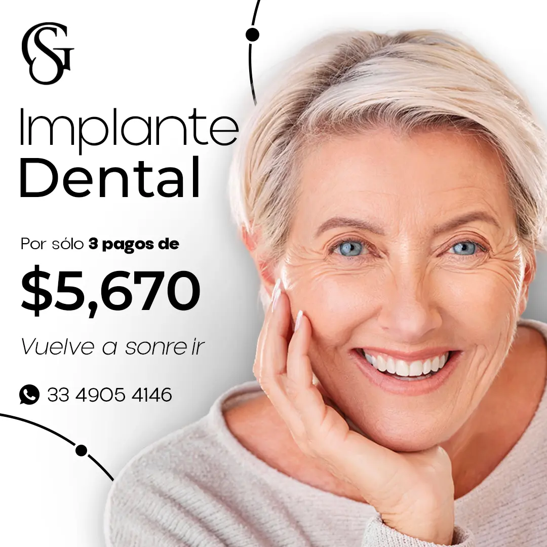 Implante Dental